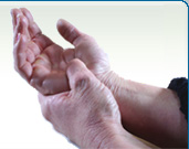 Arthritis in Hands